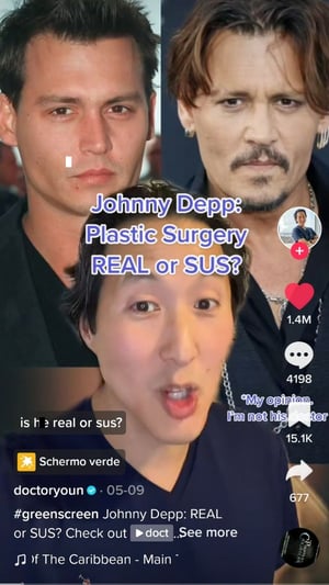 Holistics plastic surgeon Anthony Youn TikTok video series named Real or Sus. This video is about Johnny Depp