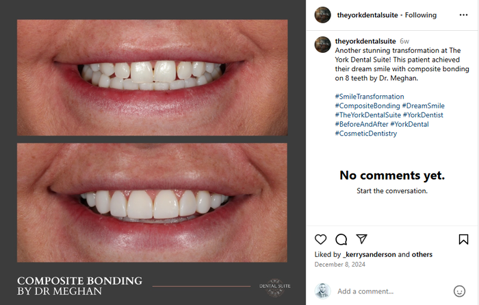 digital marketing for local businesses yorkdental screenshot example